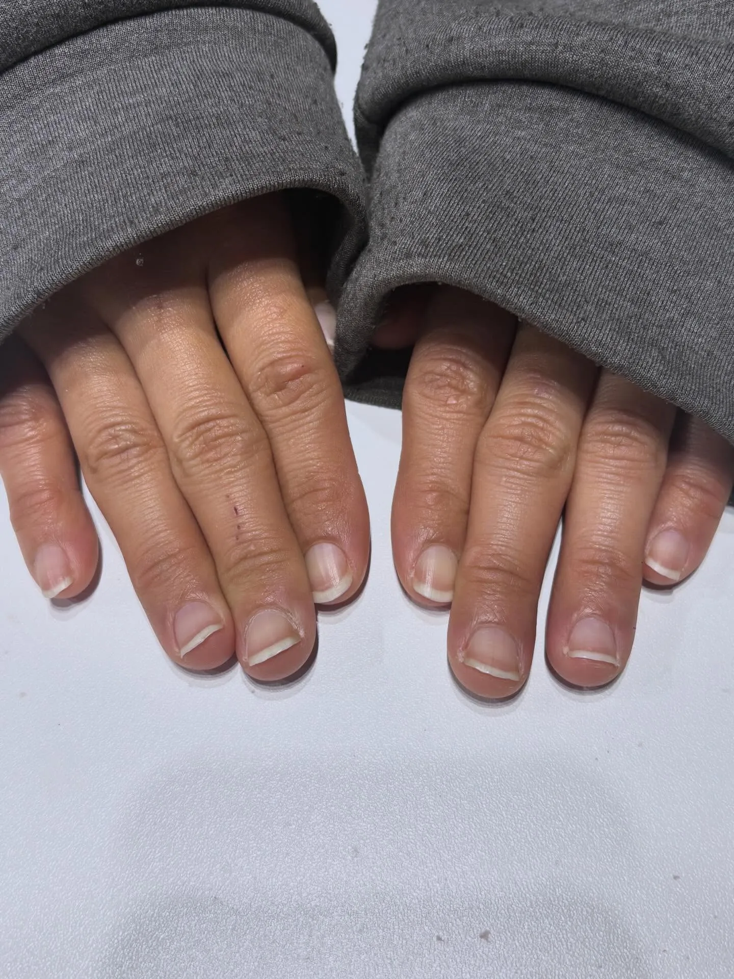 小さなお爪さんのBefore~After💅