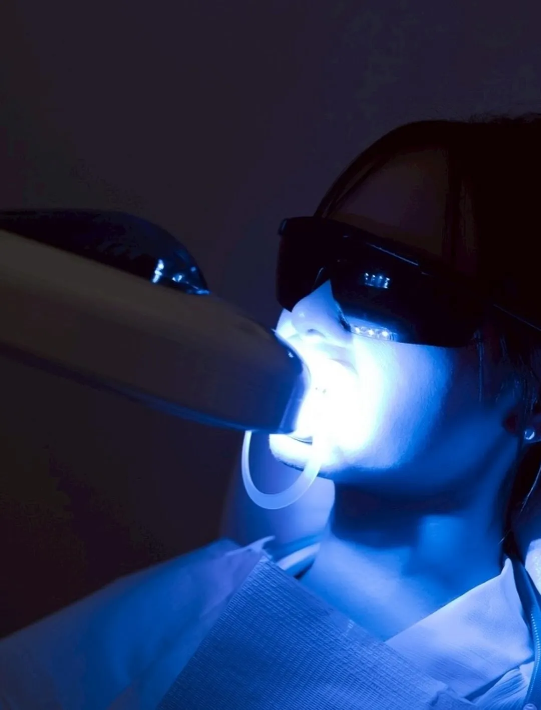 🦷✨セルフホワイトニング✨🦷